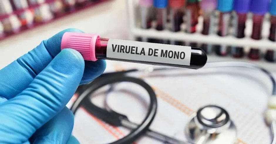 viruela de mono