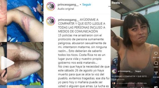 A través de sus redes sociales, una mujer de 23 años denunció una paliza por parte de la policía. El hecho fue a finales de agosto. Archivo/La República.